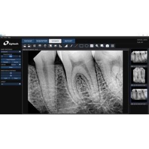 سنسور RVG ایتیس Eighteeth مدل NanoPix