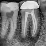 رادیوگرافی پرتابل مدل: UA-DENTAL 1