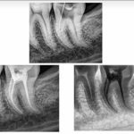 رادیوگرافی پرتابل مدل: UA-DENTAL