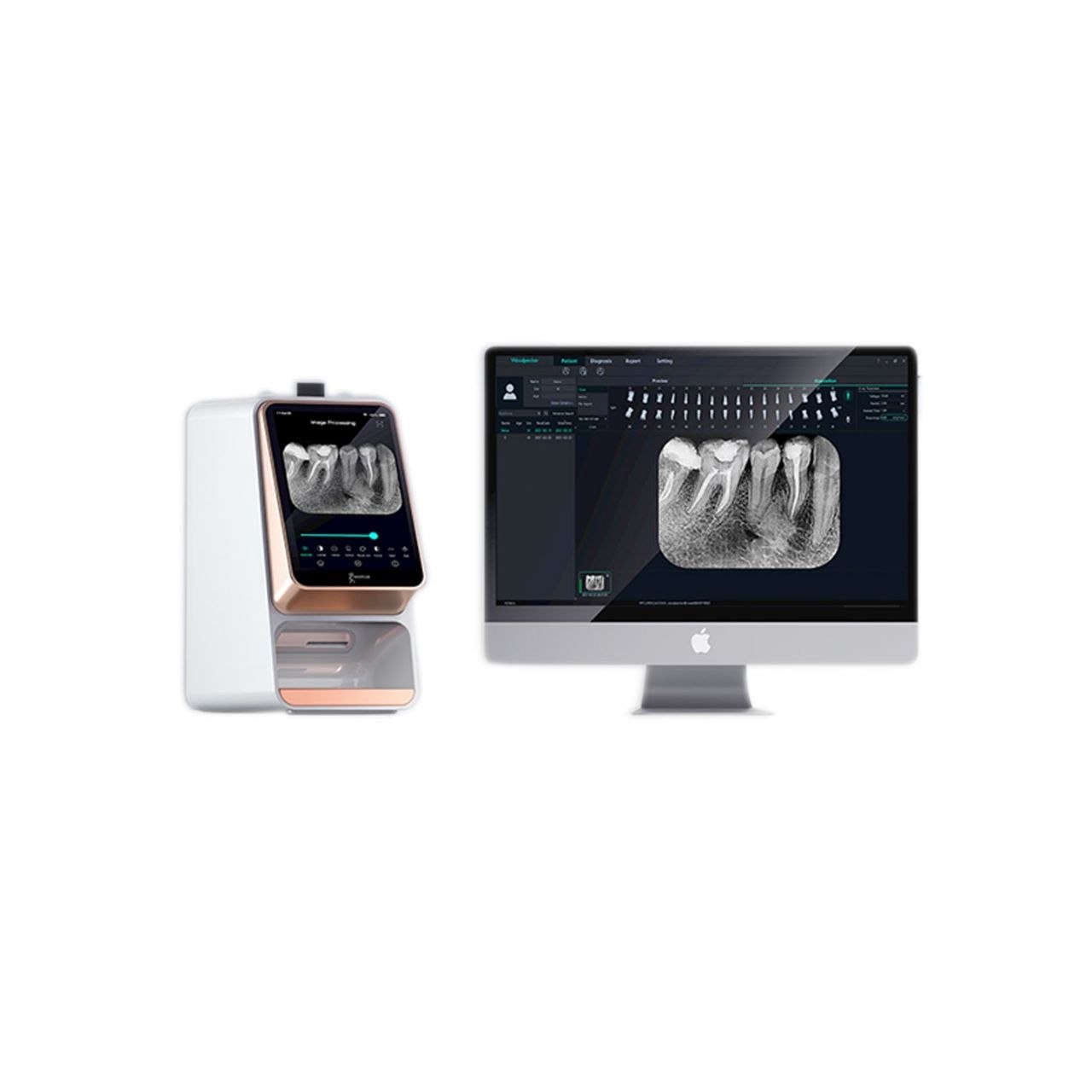فسفرپلیت وودپیکر Woodpecker مدل i-Scan Pro