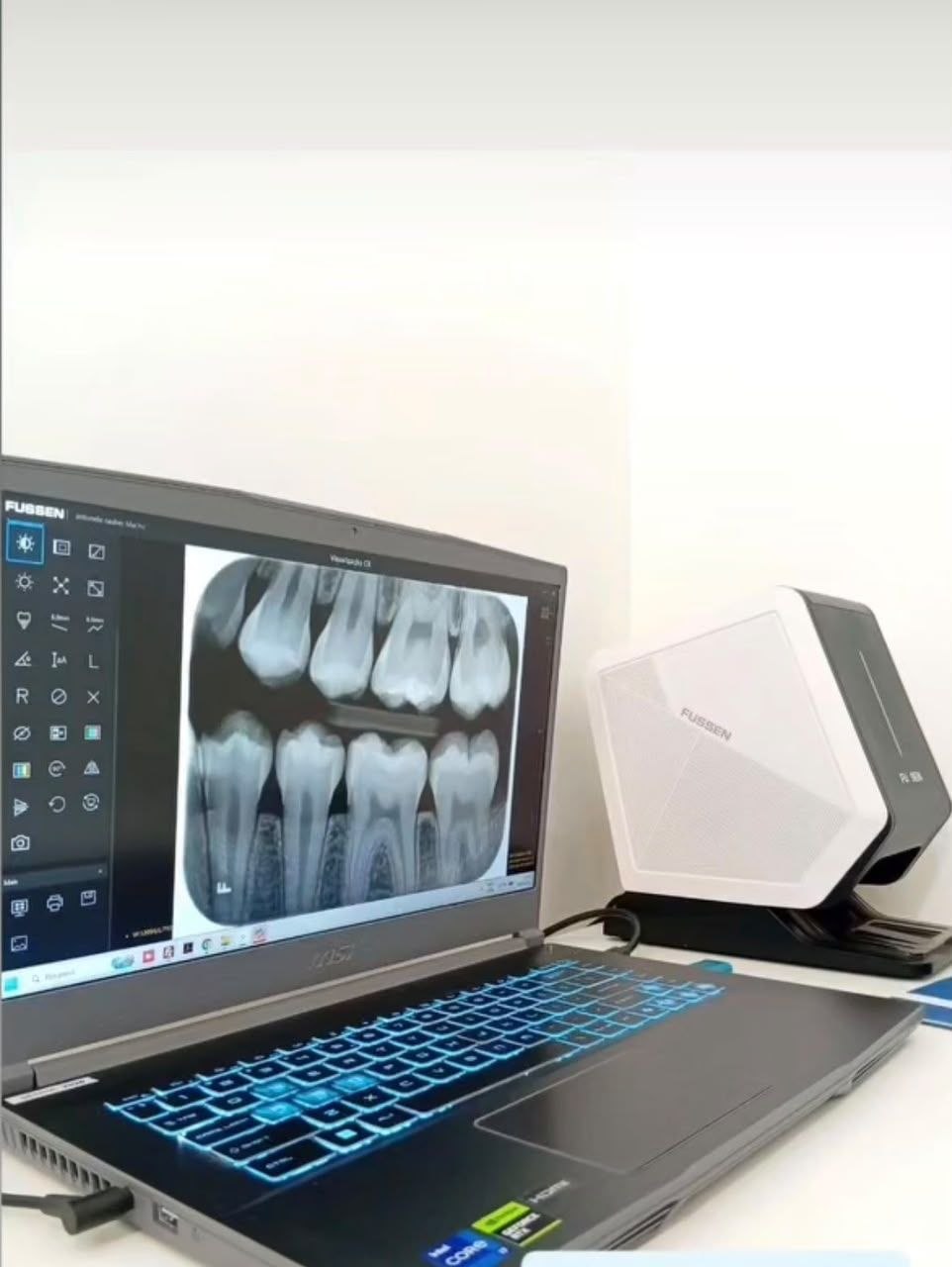 اسکنر فسفرپلیت فیوژن FUSSEN مدل F220