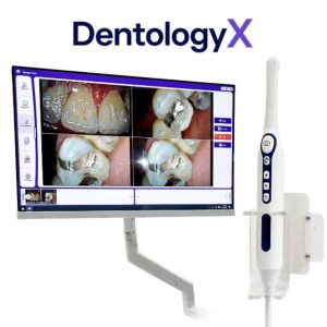 دوربین داخل دهانی All in One DentologyX