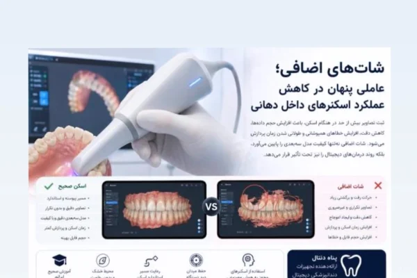 شات‌های اضافی عاملی پنهان در کاهش عملکرد اسکنرهای داخل دهانی